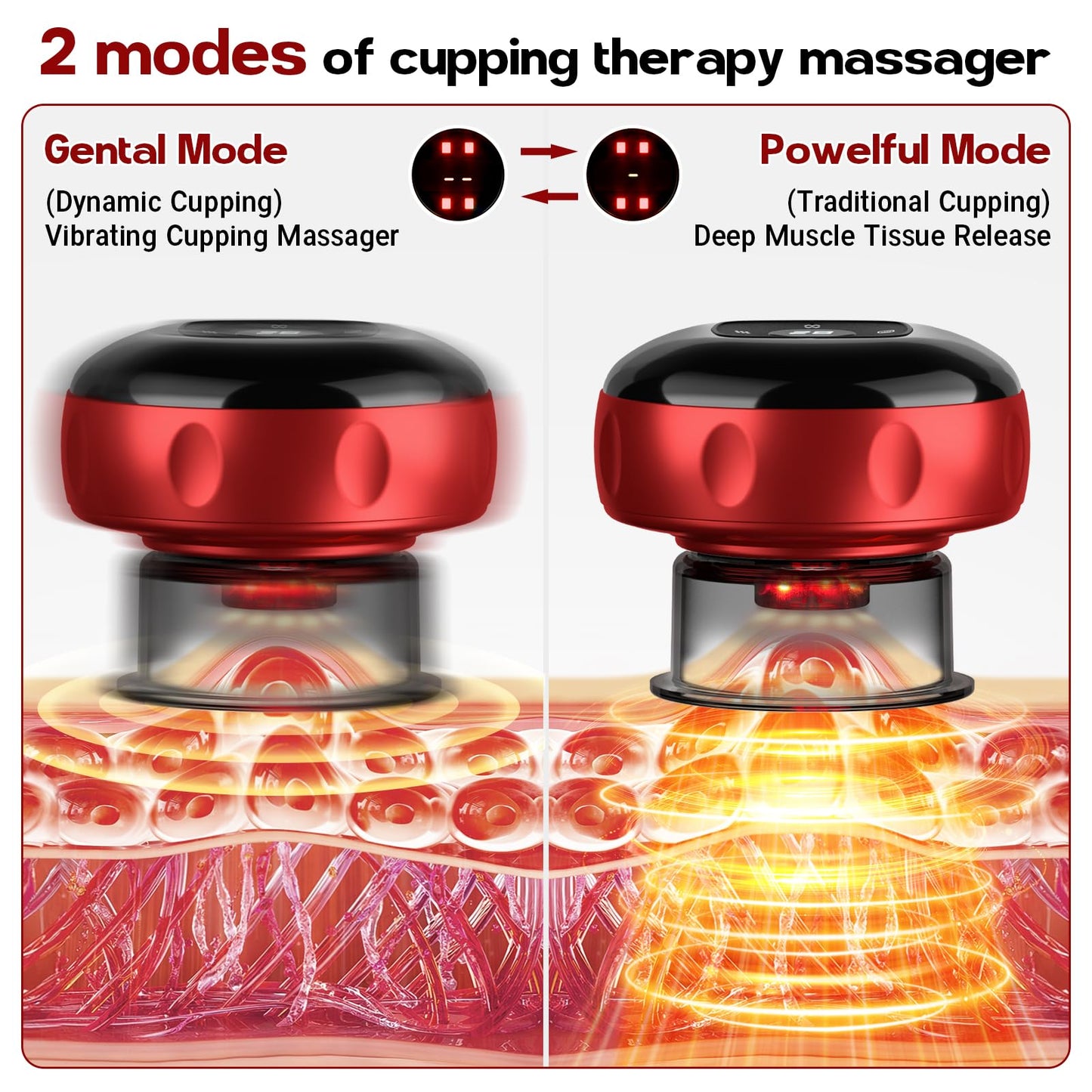 Smart Cupping Therapy Massager