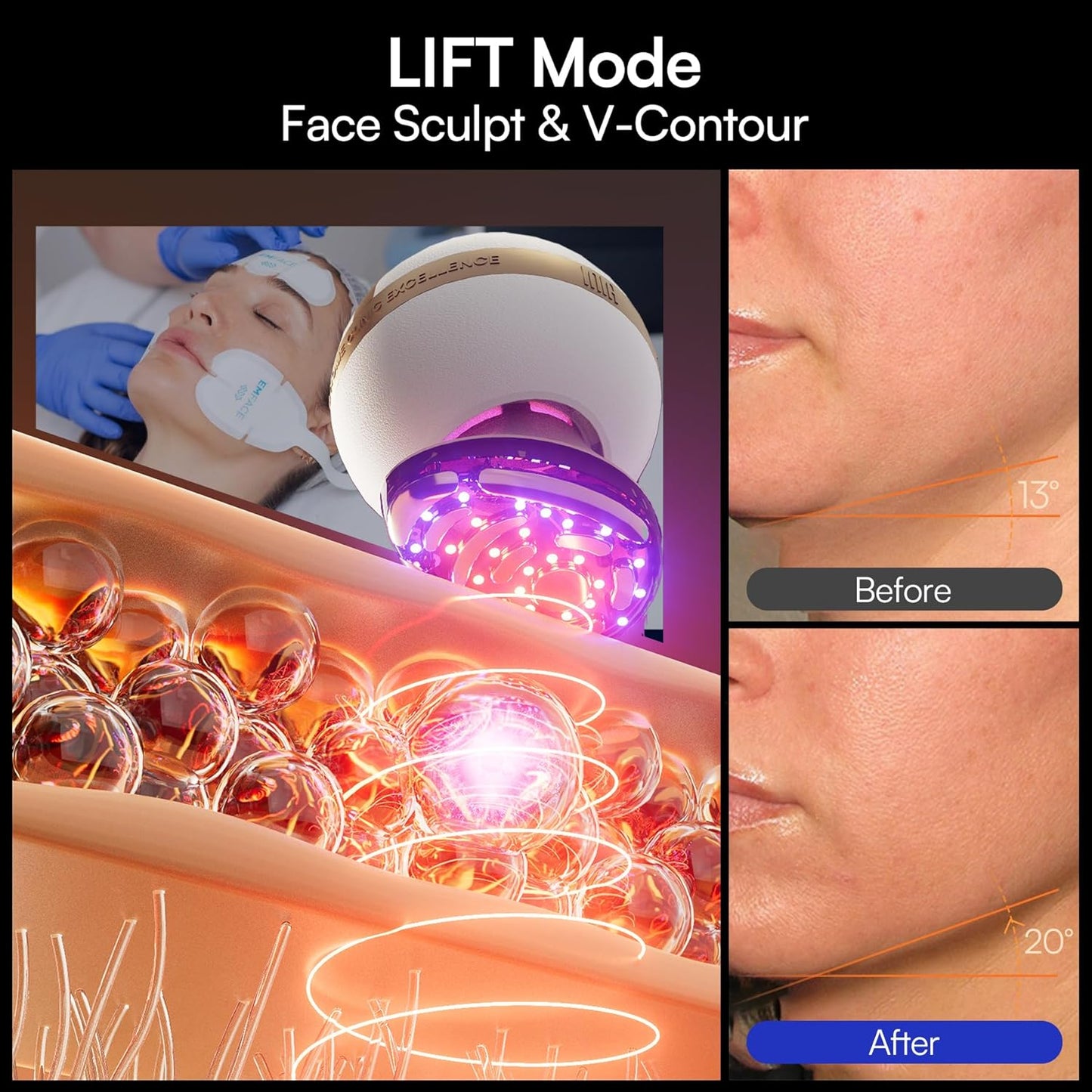 INIA SPHERA Upgraded 8-in-1 Microcurrent Facial Device for Face & Neck – Red Light, Thermal & Cooling Beauty Tool, 5 Custom Modes, At-Home Skin Stimulation & Glow Care Skincare Tool